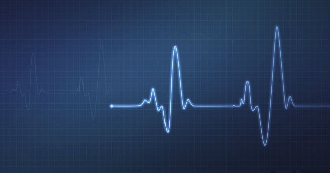 electro cardiograma